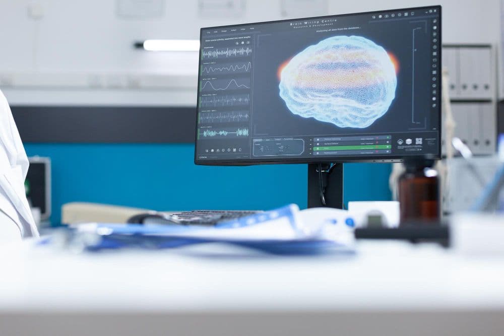 photologuephotos2023-08oficina-hospital-vacio-moderno-computadora-diagaram-cerebral-resonancia-magnetica-pantalla-listo-examen-oncologico-sala-gabinetes-equipada-herramientas-medicas-profesionales-imagen-tomografia-cerebraljpg photologuephotos2023-08oficina-hospital-vacio-moderno-computadora-diagaram-cerebral-resonancia-magnetica-pantalla-listo-examen-oncologico-sala-gabinetes-equipada-herramientas-medicas-profesionales-imagen-tomografia-cerebraljpg