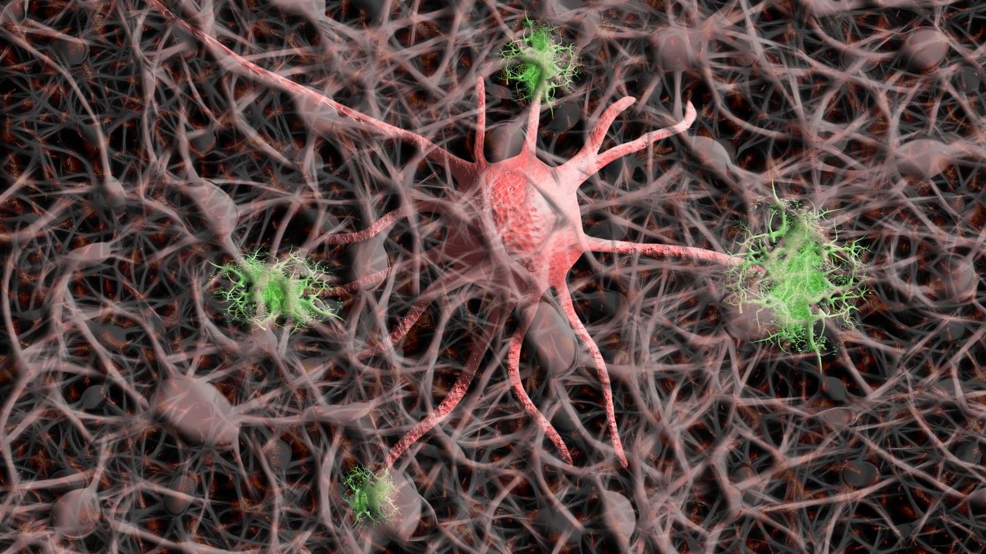 photologuephotos2023-02alzheimerjpg