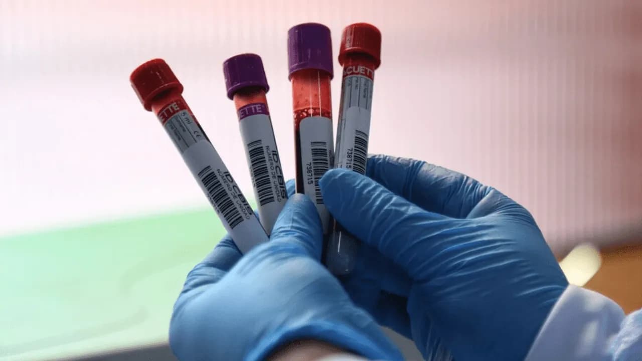 Alerta por reservas críticas de sangre en Colombia: demanda de O+ supera la capacidad de reposición