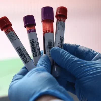 Alerta por reservas críticas de sangre en Colombia: demanda de O+ supera la capacidad de reposición