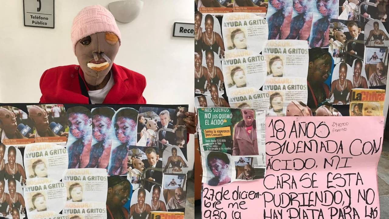 "La autorización ya existe": lo que respondió la EPS sobre la eutanasia de María Consuelo, la mujer que sobrevivió a un ataque con ácido "La autorización ya existe": lo que respondió la EPS sobre la eutanasia de María Consuelo, la mujer que sobrevivió a un ataque con ácido