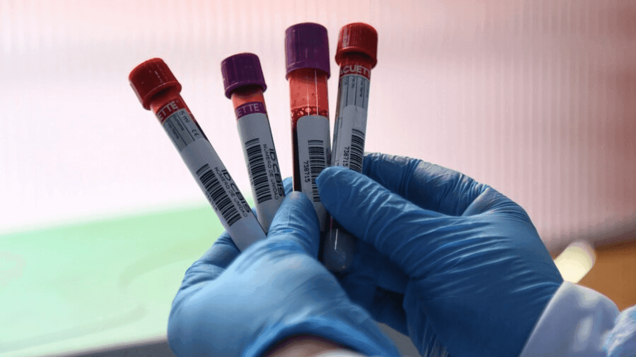 Alerta por reservas críticas de sangre en Colombia: demanda de O+ supera la capacidad de reposición Alerta por reservas críticas de sangre en Colombia: demanda de O+ supera la capacidad de reposición