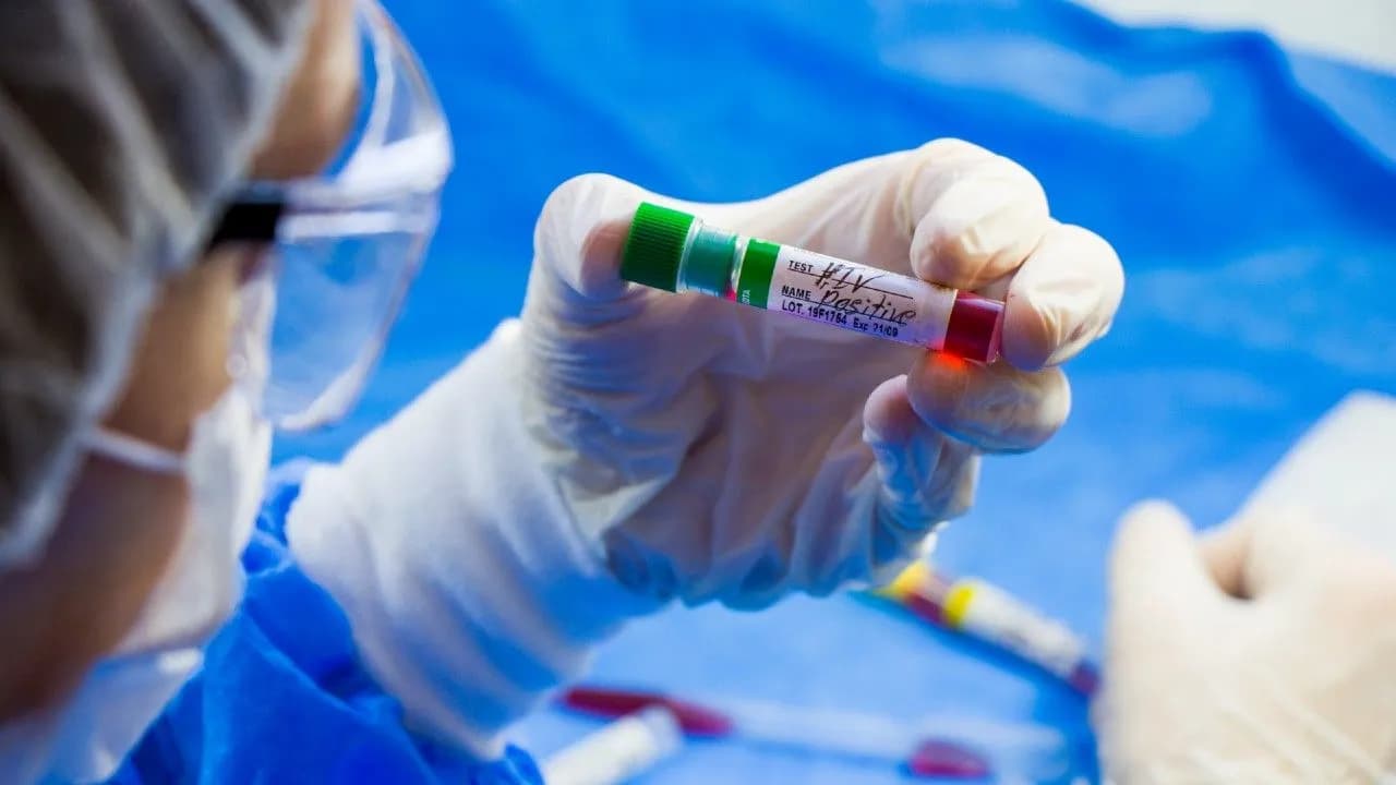 photologuephotos2024-03hiv-aids-infection-test-doctors-face-hand-holding-tube-with-blood-blue-background_1jpg photologuephotos2024-03hiv-aids-infection-test-doctors-face-hand-holding-tube-with-blood-blue-background_1jpg