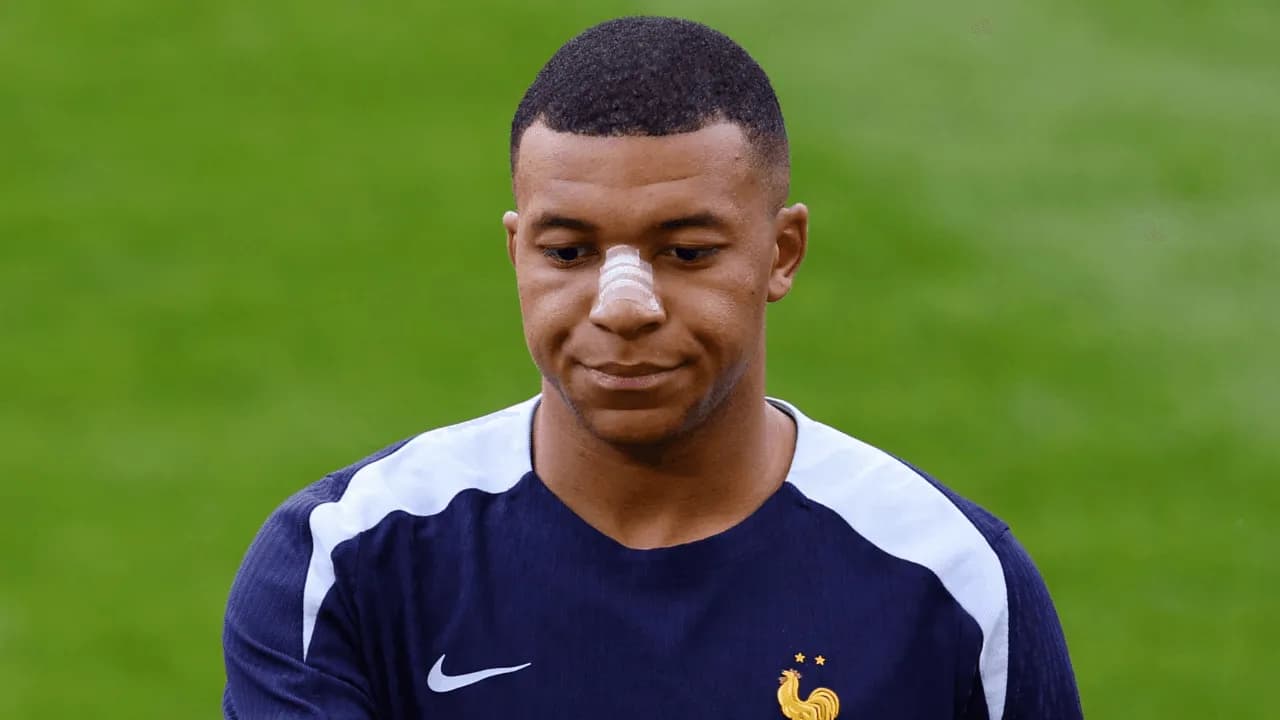 photologuephotos2024-06mbappe_con_su_fractura_de_nariz_y_la_venda_que_hace_parte_del_entrenamiento_0png photologuephotos2024-06mbappe_con_su_fractura_de_nariz_y_la_venda_que_hace_parte_del_entrenamiento_0png