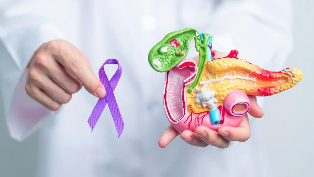 cancer de pancreas foto cancer de pancreas foto