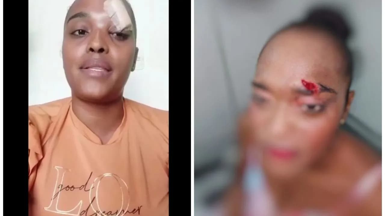 photologuephotos2022-12mujer_agredida_denunciajpeg photologuephotos2022-12mujer_agredida_denunciajpeg