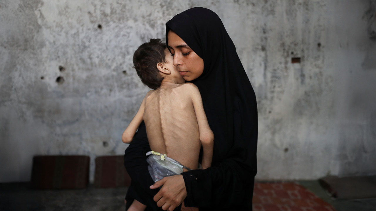 Agosto fue el mes más mortífero por hambruna en Gaza desde el inicio del asedio israelí
