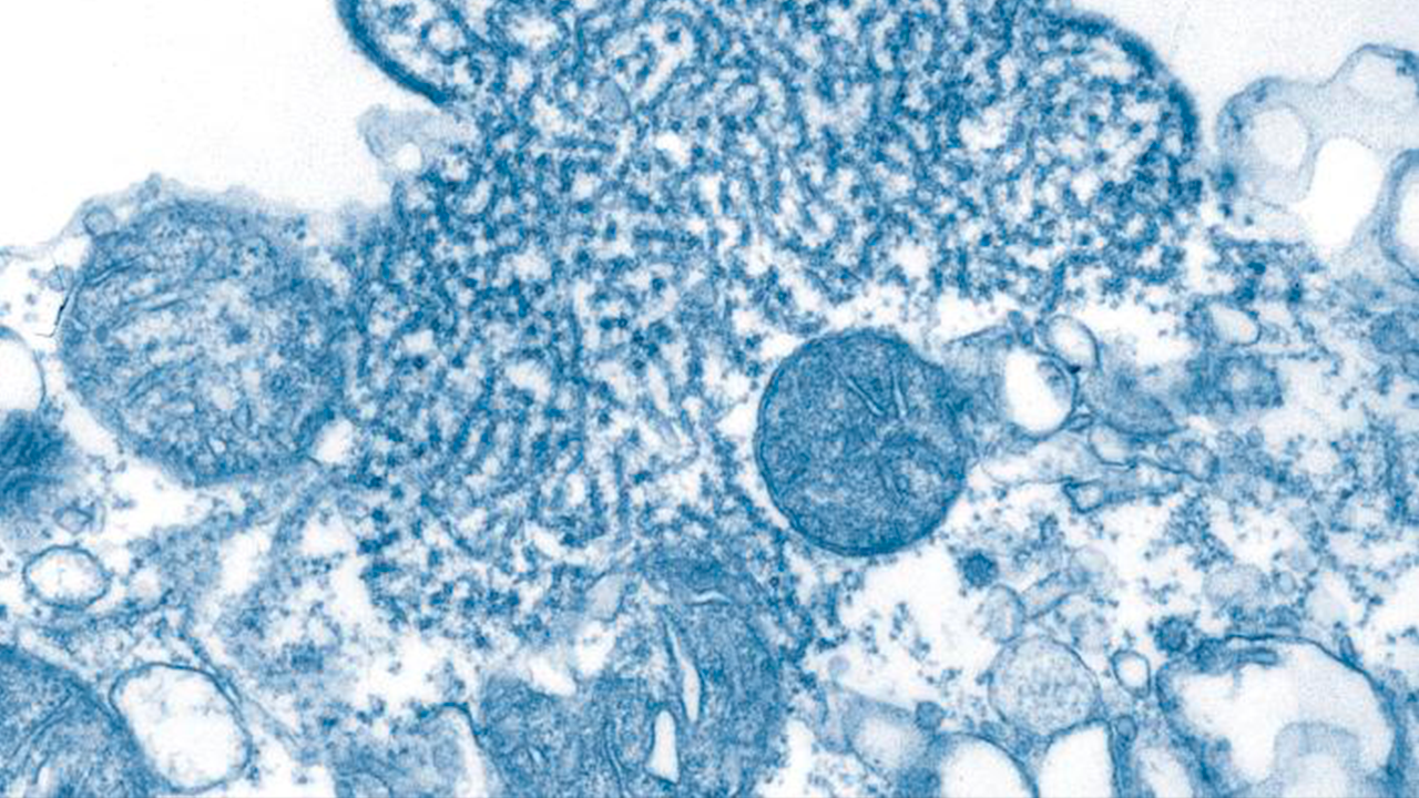 Virus Nipah bajo un microscopio electrónico de transmisión