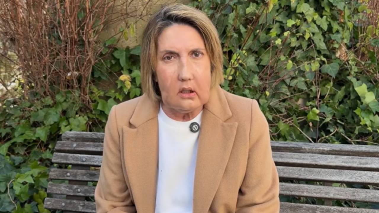 Mujer que recibió la donación de rostro. Crédito: Vall d’Hebron